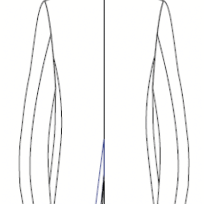 Image for choice number 2