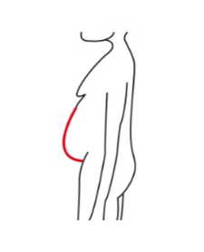 Image for choice number 3